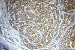 DKK3 Antibody in Immunohistochemistry (Paraffin) (IHC (P))