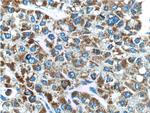 DKK3 Antibody in Immunohistochemistry (Paraffin) (IHC (P))