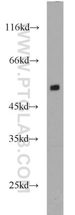 DKK3 Antibody in Western Blot (WB)