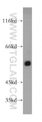 DKK3 Antibody in Western Blot (WB)