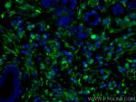 Vimentin Antibody in Immunohistochemistry (PFA fixed) (IHC (PFA))