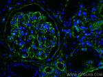 Vimentin Antibody in Immunohistochemistry (PFA fixed) (IHC (PFA))