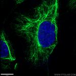 Vimentin Antibody in Immunocytochemistry (ICC/IF)