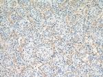 Vimentin Antibody in Immunohistochemistry (Paraffin) (IHC (P))