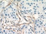 Vimentin Antibody in Immunohistochemistry (Paraffin) (IHC (P))