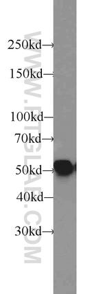 Vimentin Antibody in Western Blot (WB)