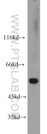 Vimentin Antibody in Western Blot (WB)