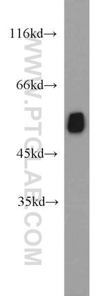 Vimentin Antibody in Western Blot (WB)