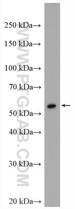 Vimentin Antibody in Western Blot (WB)