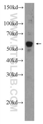 Vimentin Antibody in Western Blot (WB)