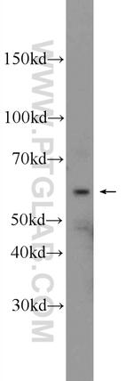 Vimentin Antibody in Western Blot (WB)