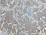 ERBB3 Antibody in Immunohistochemistry (Paraffin) (IHC (P))