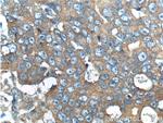 ERBB3 Antibody in Immunohistochemistry (Paraffin) (IHC (P))