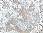 ERBB3 Antibody in Immunohistochemistry (Paraffin) (IHC (P))