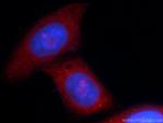 MOV10 Antibody in Immunocytochemistry (ICC/IF)