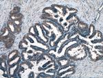 MOV10 Antibody in Immunohistochemistry (Paraffin) (IHC (P))