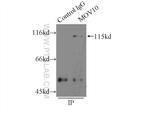 MOV10 Antibody in Immunoprecipitation (IP)