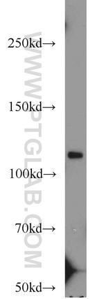 MOV10 Antibody in Western Blot (WB)