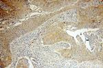 MMP1 Antibody in Immunohistochemistry (Paraffin) (IHC (P))