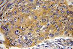 MMP1 Antibody in Immunohistochemistry (Paraffin) (IHC (P))