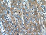 MMP1 Antibody in Immunohistochemistry (Paraffin) (IHC (P))