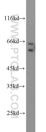 MMP1 Antibody in Western Blot (WB)