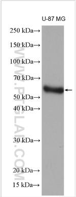 MMP1 Antibody in Western Blot (WB)