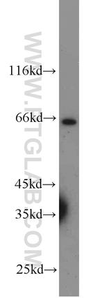 MMP1 Antibody in Western Blot (WB)