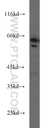 MMP1 Antibody in Western Blot (WB)