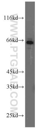 MMP1 Antibody in Western Blot (WB)