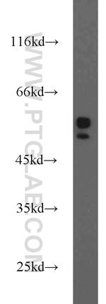 MMP1 Antibody in Western Blot (WB)