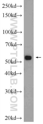 MMP1 Antibody in Western Blot (WB)