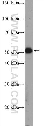 MMP1 Antibody in Western Blot (WB)