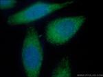 MMP2 Antibody in Immunocytochemistry (ICC/IF)