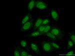 MMP2 Antibody in Immunocytochemistry (ICC/IF)