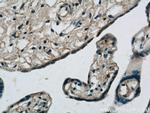 MMP2 Antibody in Immunohistochemistry (Paraffin) (IHC (P))