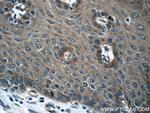 MMP2 Antibody in Immunohistochemistry (Paraffin) (IHC (P))