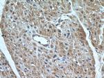 MMP2 Antibody in Immunohistochemistry (Paraffin) (IHC (P))