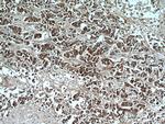 MMP2 Antibody in Immunohistochemistry (Paraffin) (IHC (P))