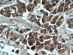 MMP2 Antibody in Immunohistochemistry (Paraffin) (IHC (P))