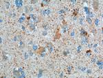 MMP2 Antibody in Immunohistochemistry (Paraffin) (IHC (P))