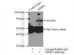 MMP2 Antibody in Immunoprecipitation (IP)