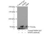 MMP2 Antibody in Immunoprecipitation (IP)