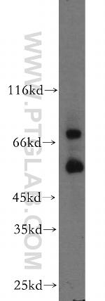 MMP2 Antibody in Western Blot (WB)