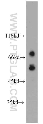 MMP2 Antibody in Western Blot (WB)