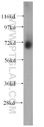 MMP2 Antibody in Western Blot (WB)