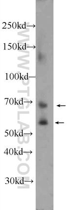 MMP2 Antibody in Western Blot (WB)