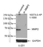 MMP2 Antibody in Western Blot (WB)