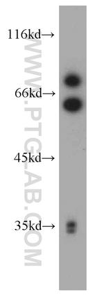 MMP2 Antibody in Western Blot (WB)