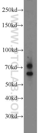 MMP2 Antibody in Western Blot (WB)